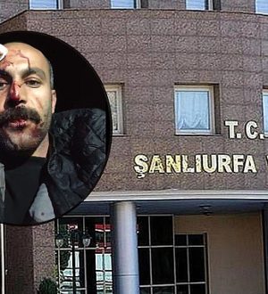 Şanlıurfa Valiliği’nden Avukata Darp Olayı İle İlgili Açıklama!