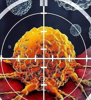 Şanlıurfa, Kanserden Kaynaklı Ölümlerde Dikkat Çeken Detay!