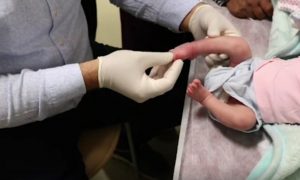 SİVEREK DEVLET HASTANESİNDE BAŞARILI OPERASYON