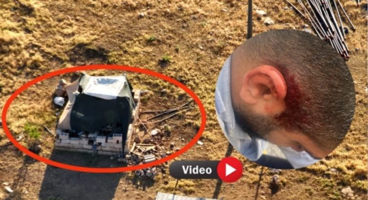  Dicle Elektrik Personeli Saldırıya Uğradı, Kaçak Trafo Ölüm Getirdi