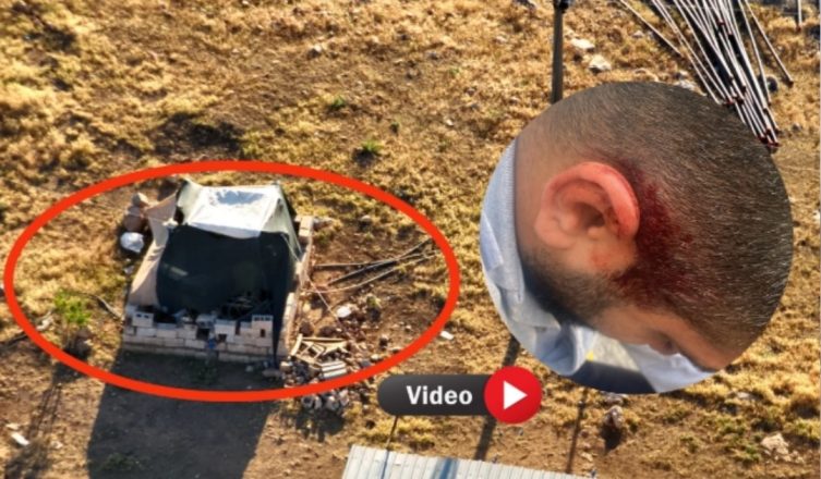 Dicle Elektrik Personeli Saldırıya Uğradı, Kaçak Trafo Ölüm Getirdi